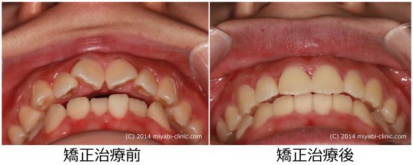 352_20170328_1731_⑦その他の保存する写真１-2