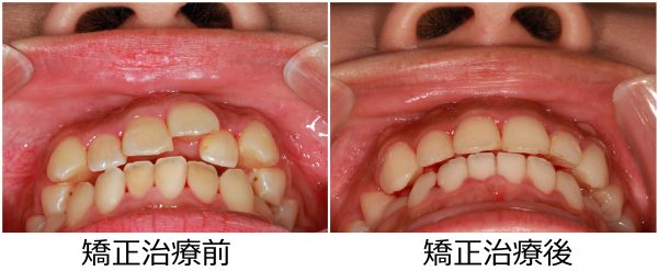 338_20170303_1800_⑦その他の保存する写真１ - コピー